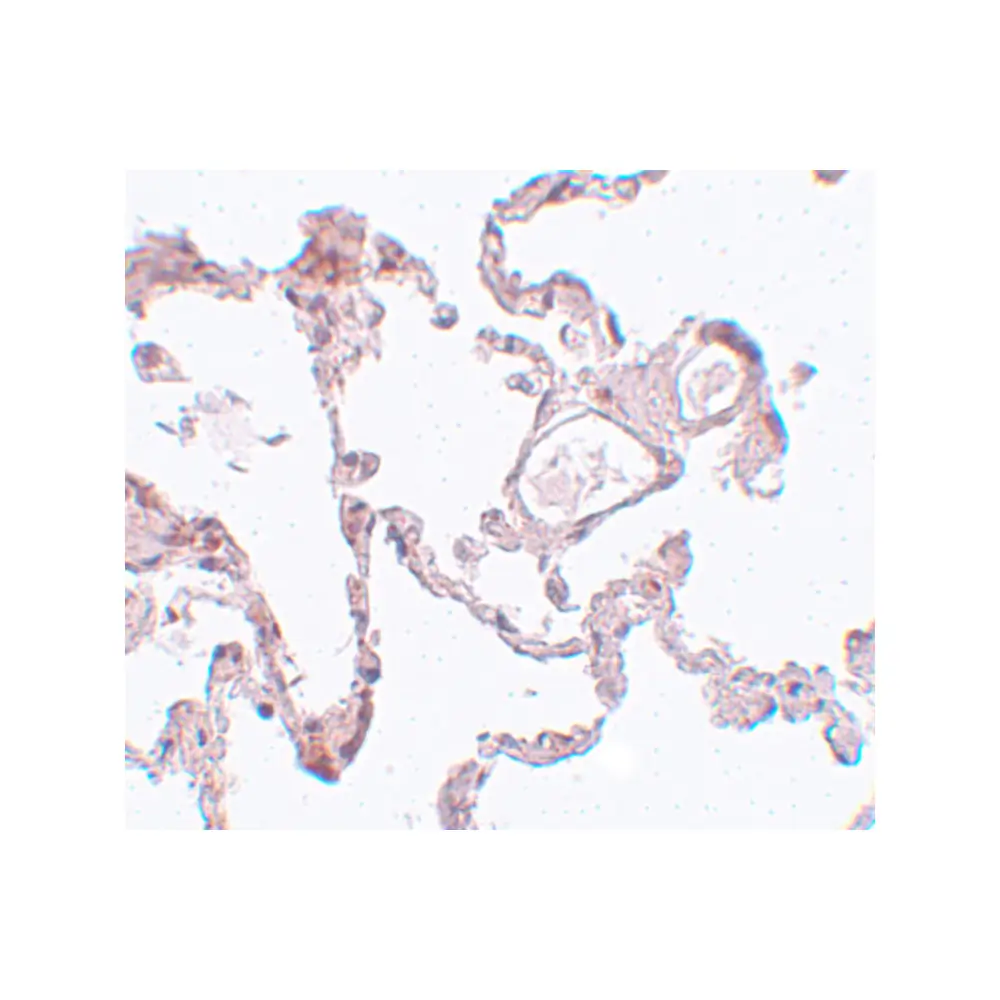 ProSci 5483 PLEKHM1 Antibody, ProSci, 0.1 mg/Unit Secondary Image