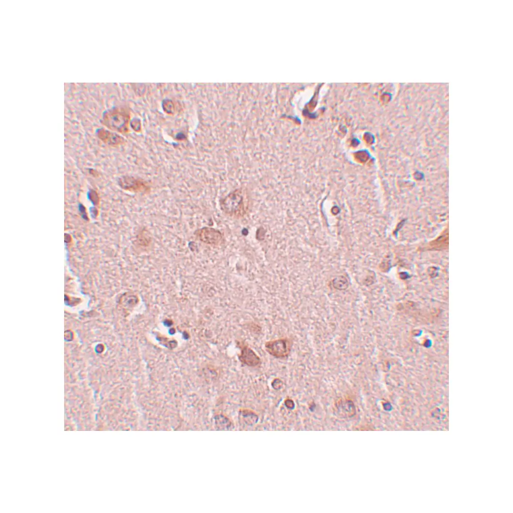 ProSci 5485_S PLEKHM2 Antibody, ProSci, 0.02 mg/Unit Secondary Image