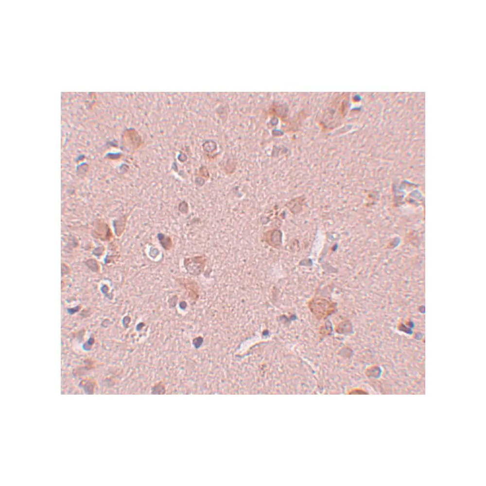 ProSci 5487_S PLEKHM3 Antibody, ProSci, 0.02 mg/Unit Secondary Image