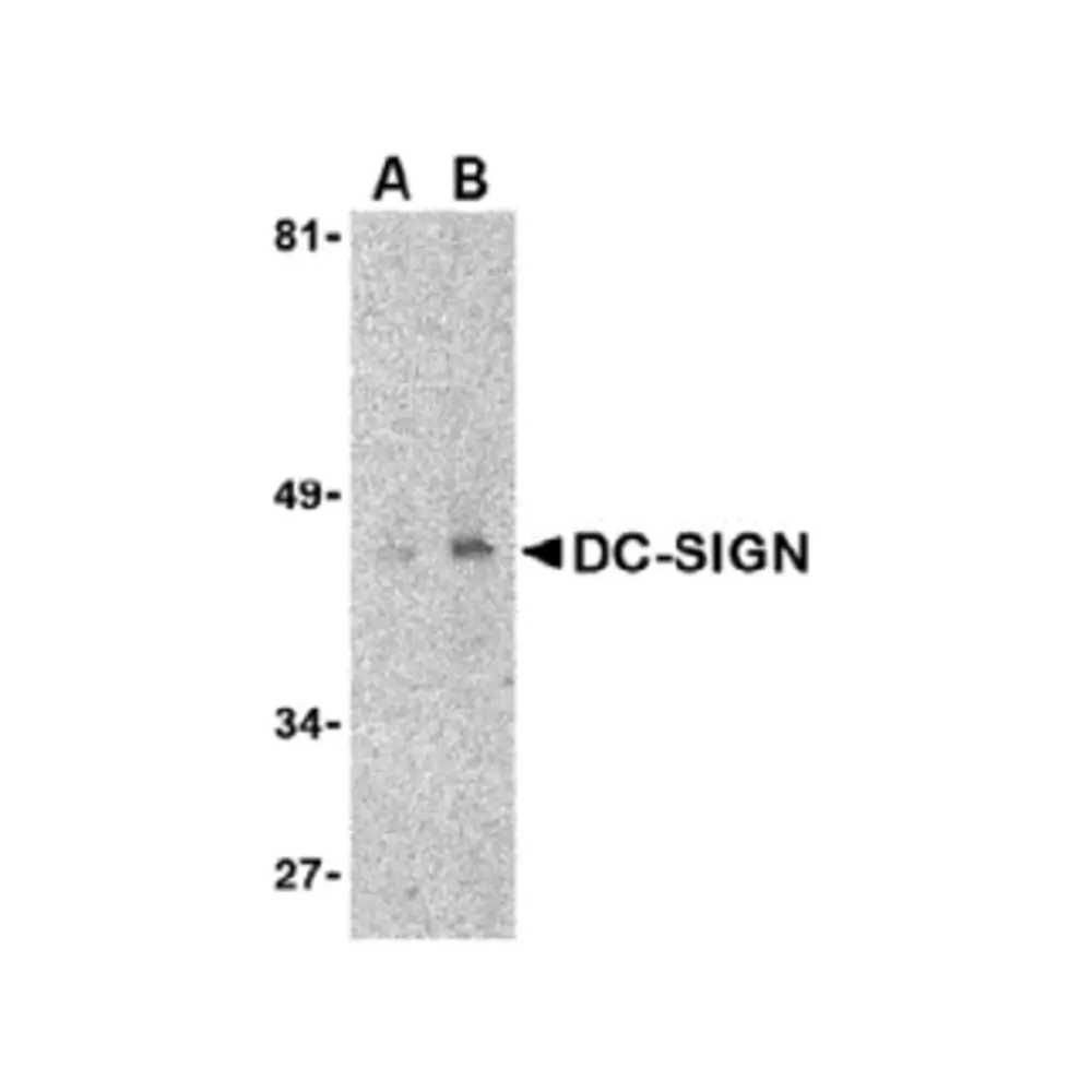ProSci PM-2348 DC-SIGN Antibody [8B6] , ProSci, 0.1 mg/Unit Primary Image