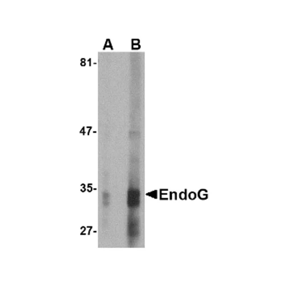ProSci PM-4577_S EndoG Antibody [7G1C10] , ProSci, 0.02 mg/Unit Primary Image