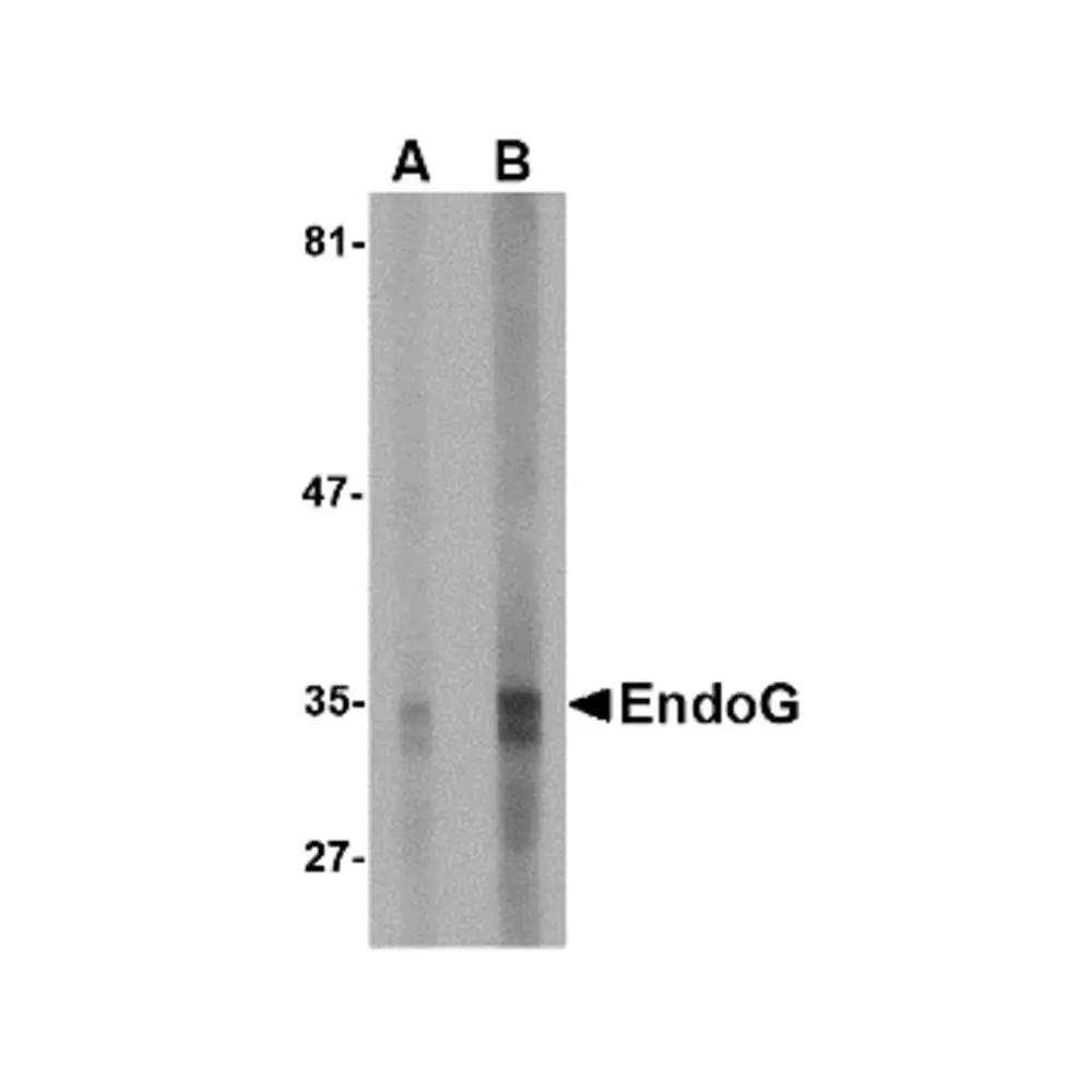 ProSci PM-4579 EndoG Antibody [7G1G10] , ProSci, 0.1 mg/Unit Primary Image