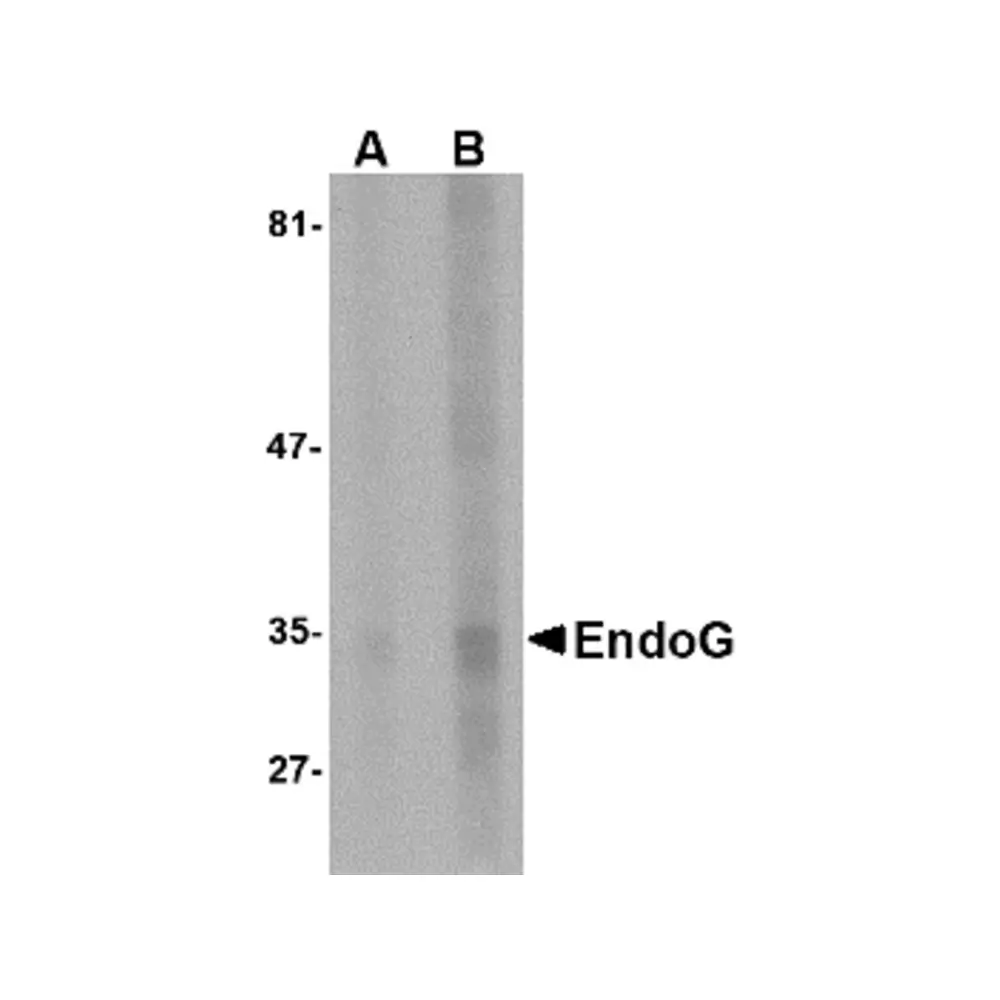ProSci PM-4581 EndoG Antibody [7F2D7] , ProSci, 0.1 mg/Unit Primary Image