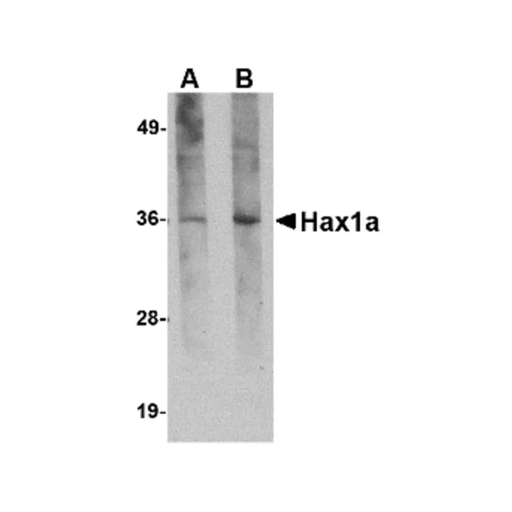 ProSci PM-4717_S Hax1a Antibody [8F9G7] , ProSci, 0.02 mg/Unit Primary Image