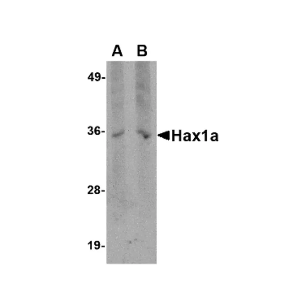 ProSci PM-4718_S Hax1a Antibody [9F3D11], ProSci, 0.02 mg/Unit Primary Image