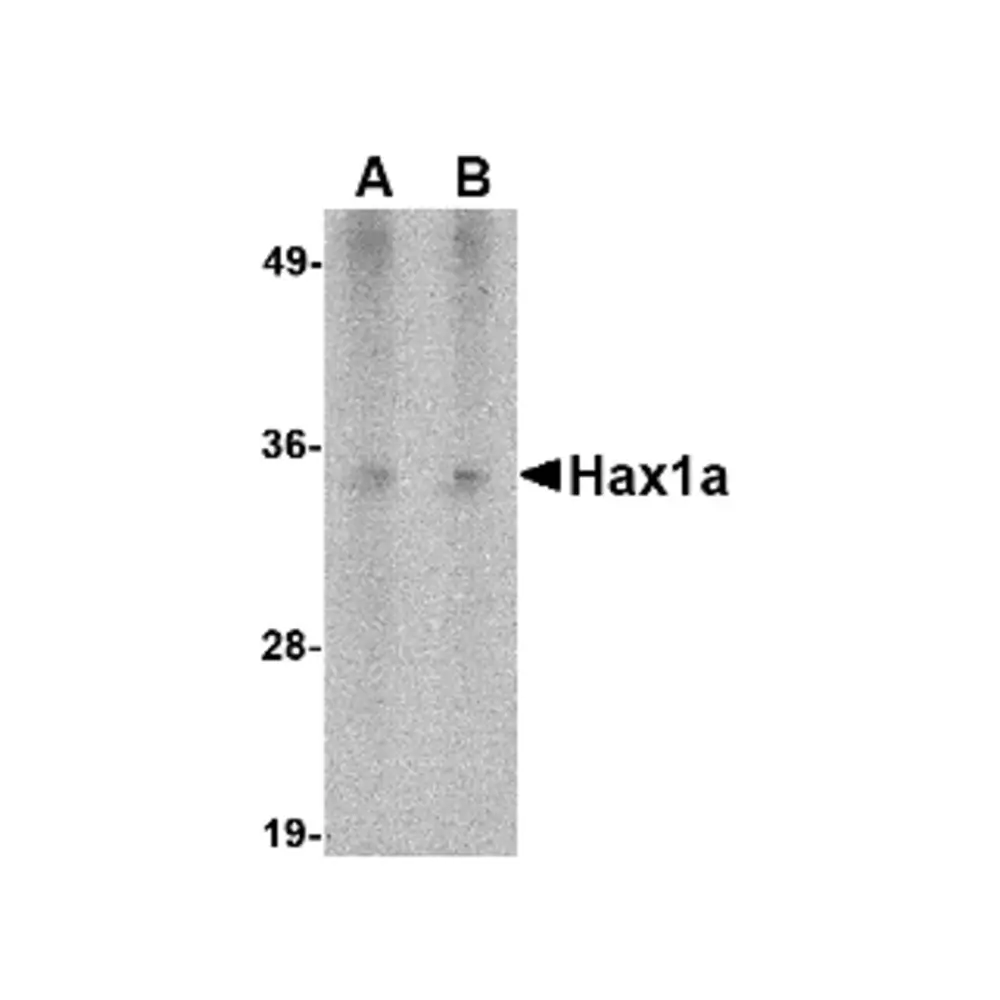 ProSci PM-4723_S Hax1a Antibody [9G6C6] , ProSci, 0.02 mg/Unit Primary Image