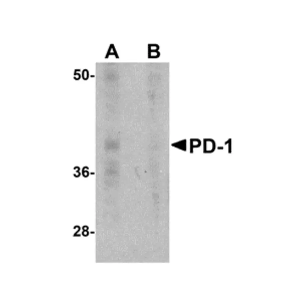 ProSci PM-5177_S PD-1 Antibody [7A11B1] , ProSci, 0.02 mg/Unit Primary Image