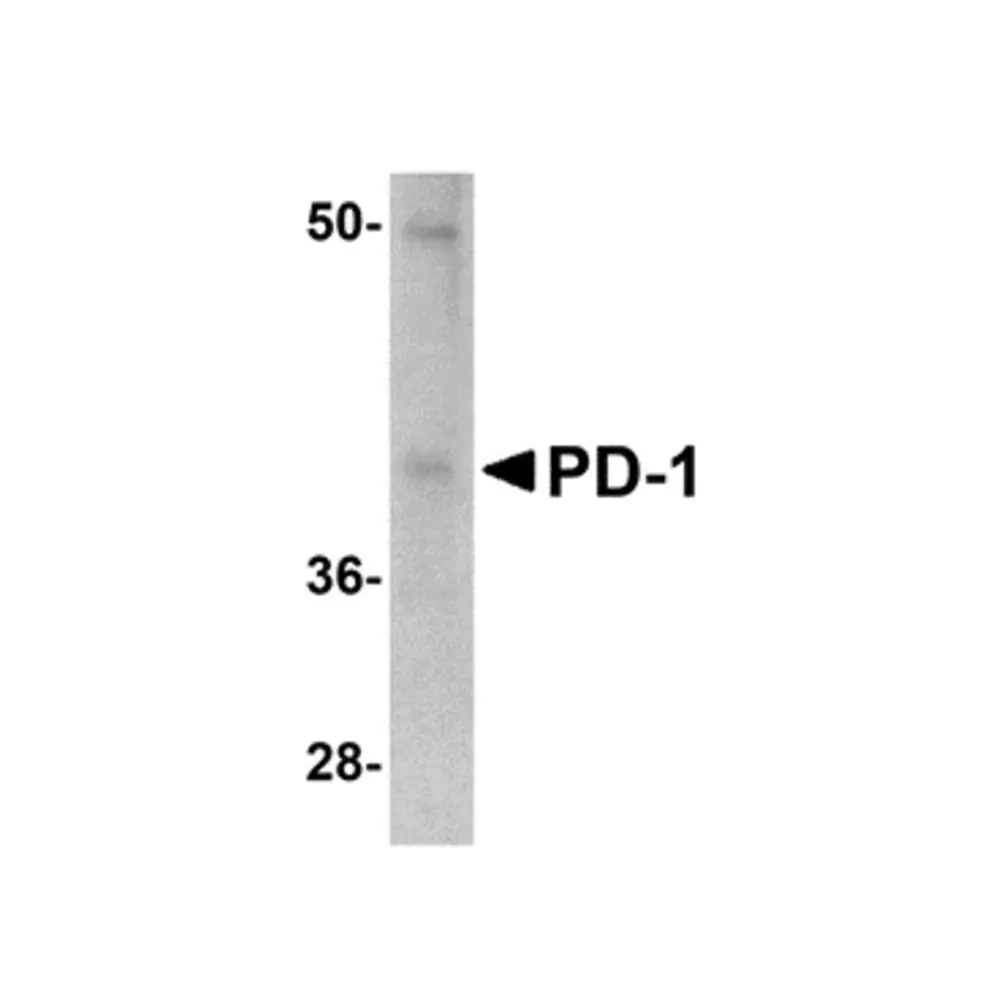 ProSci PM-5179 PD-1 Antibody [12A7D7] , ProSci, 0.1 mg/Unit Primary Image