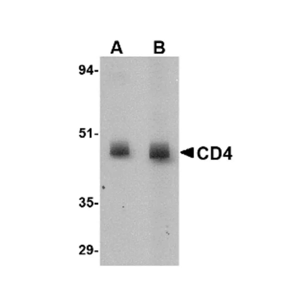 ProSci PM-5203_S CD4 Antibody [8G1B12] , ProSci, 0.02 mg/Unit Primary Image