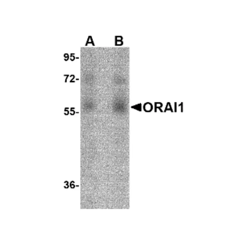 ProSci PM-5205_S ORAI1 Antibody [3F6H5] , ProSci, 0.02 mg/Unit Primary Image