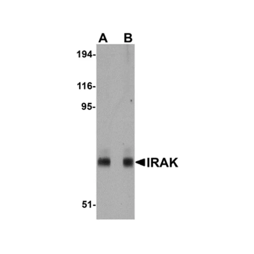 ProSci PM-5317_S IRAK Antibody [8F1A7] , ProSci, 0.02 mg/Unit Primary Image