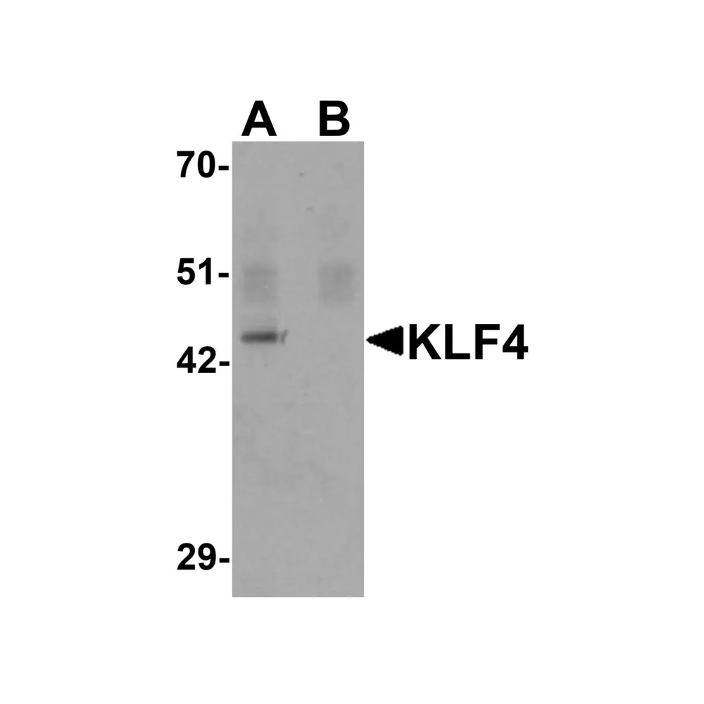 ProSci PM-6141_S KLF4 Antibody [4G6E11] , ProSci, 0.02 mg/Unit Primary Image