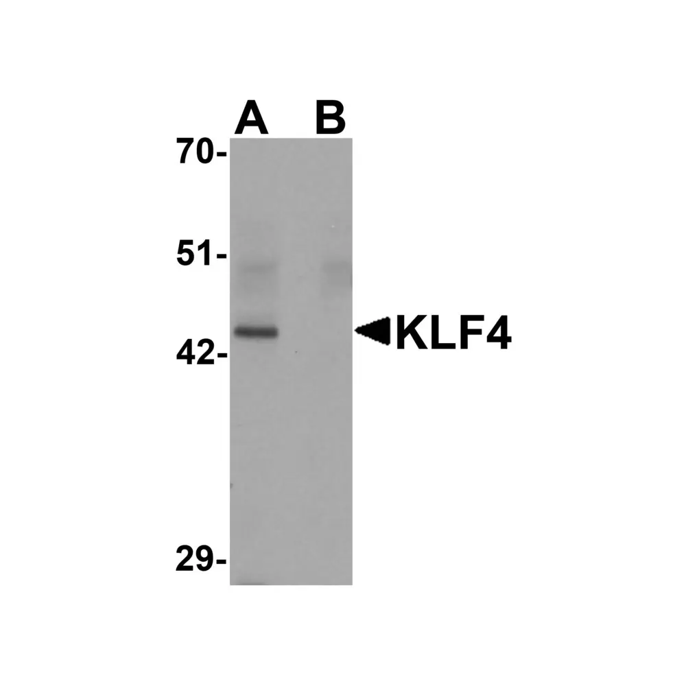 ProSci PM-6142_S KLF4 Antibody [4E5C3] , ProSci, 0.02 mg/Unit Primary Image