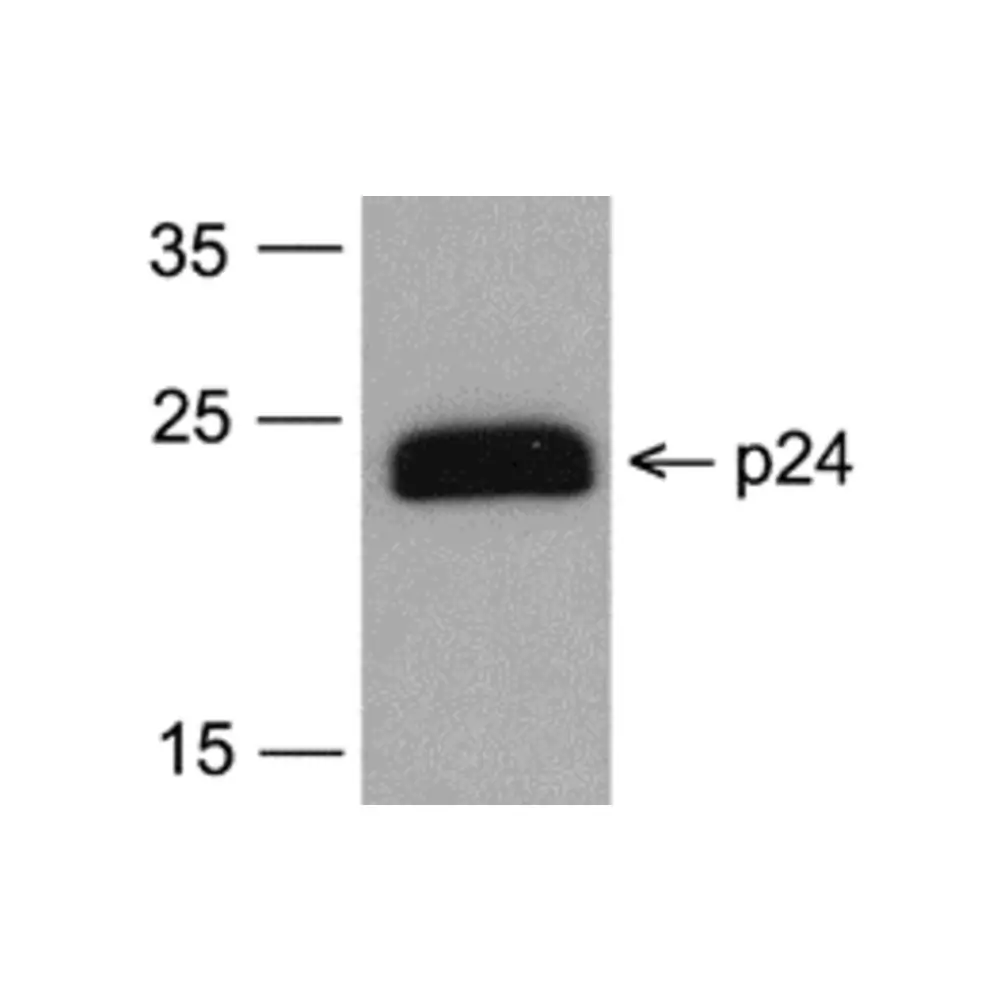 ProSci PM-6585-biotin HIV-1 p24 Antibody [7F4] (biotin), ProSci, 0.1 mg/Unit Primary Image