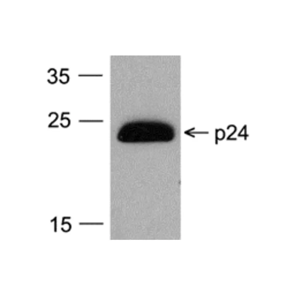 ProSci PM-6585-HRP_S HIV-1 p24 Antibody [7F4] (HRP), ProSci, 0.02 mg/Unit Primary Image