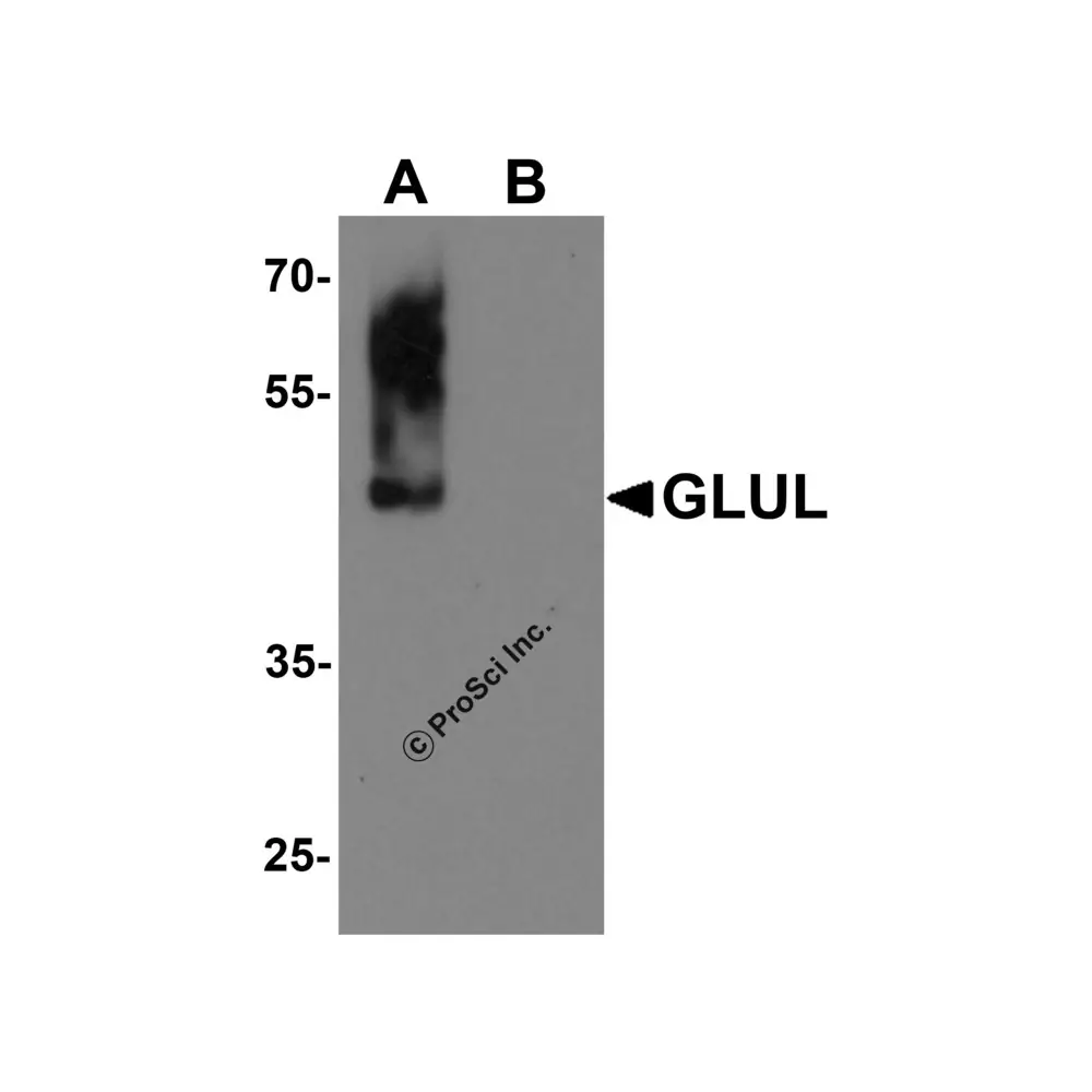 ProSci PM-7209_S GLUL Monoclonal Antibody, ProSci, 0.02 mg/Unit Primary Image