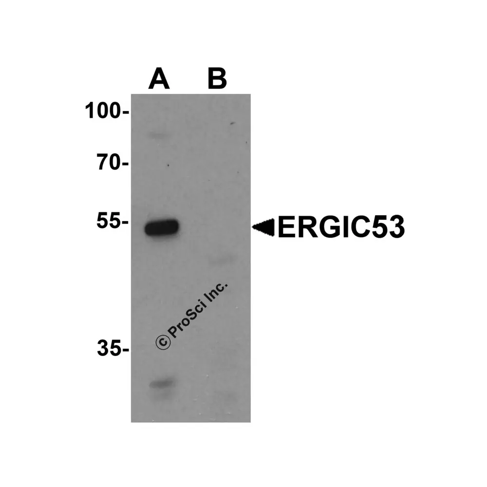 ProSci PM-7213_S ERGIC53 Monoclonal Antibody, ProSci, 0.02 mg/Unit Primary Image