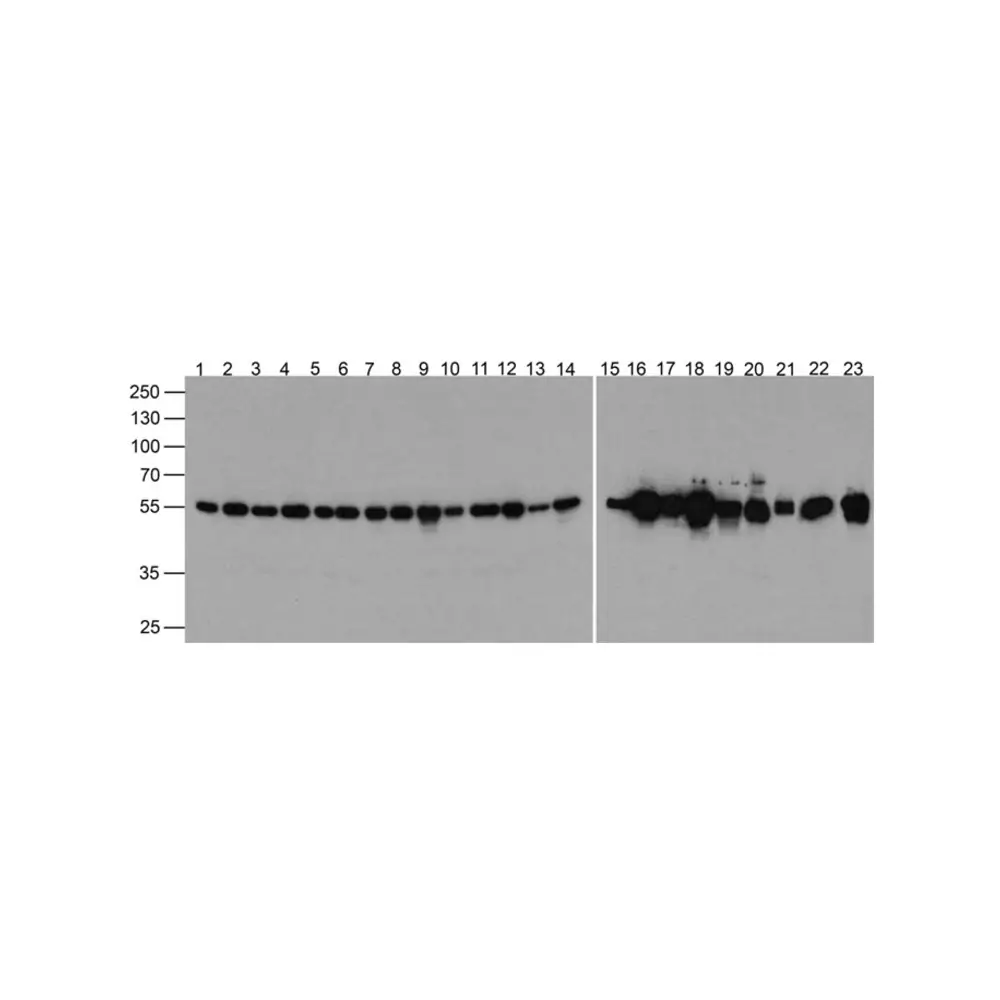 ProSci PM-7547 beta-Actin Antibody [10B7], ProSci, 0.1 mg/Unit Primary Image