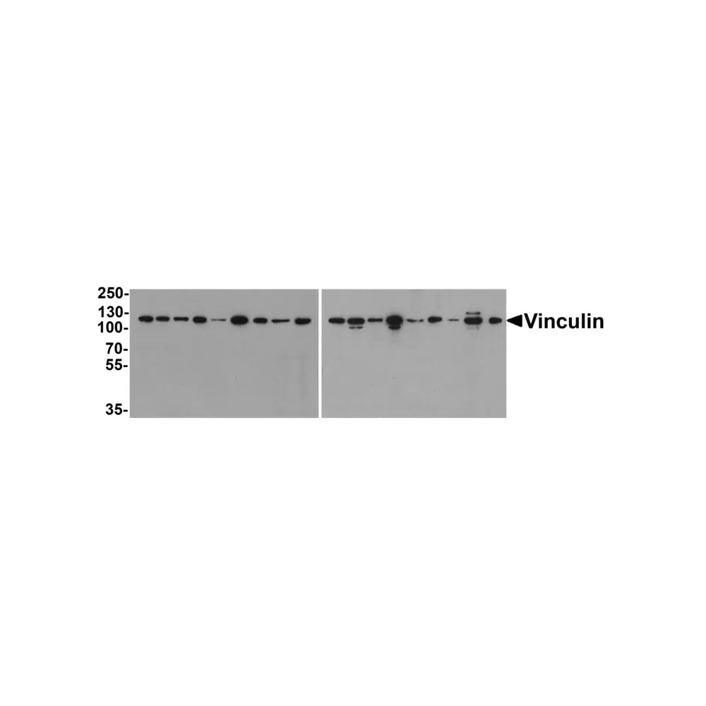 ProSci PM-7811 Vinculin Antibody [7E10], ProSci, 0.1 mg/Unit Primary Image