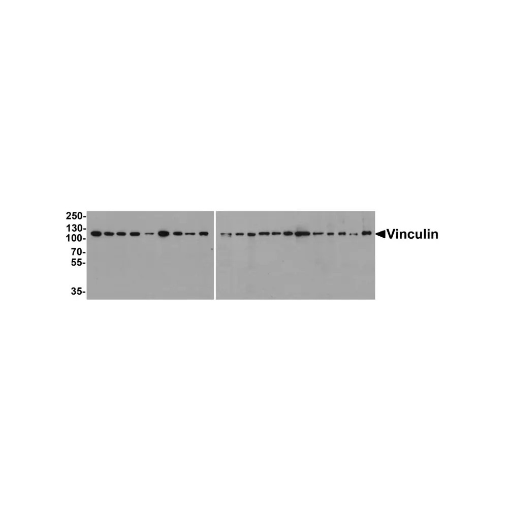 ProSci PM-7813_S Vinculin Antibody [8B5], ProSci, 0.02 mg/Unit Primary Image