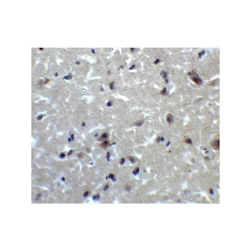 ProSci 5555_S PRDM16 Antibody, ProSci, 0.02 mg/Unit Secondary Image