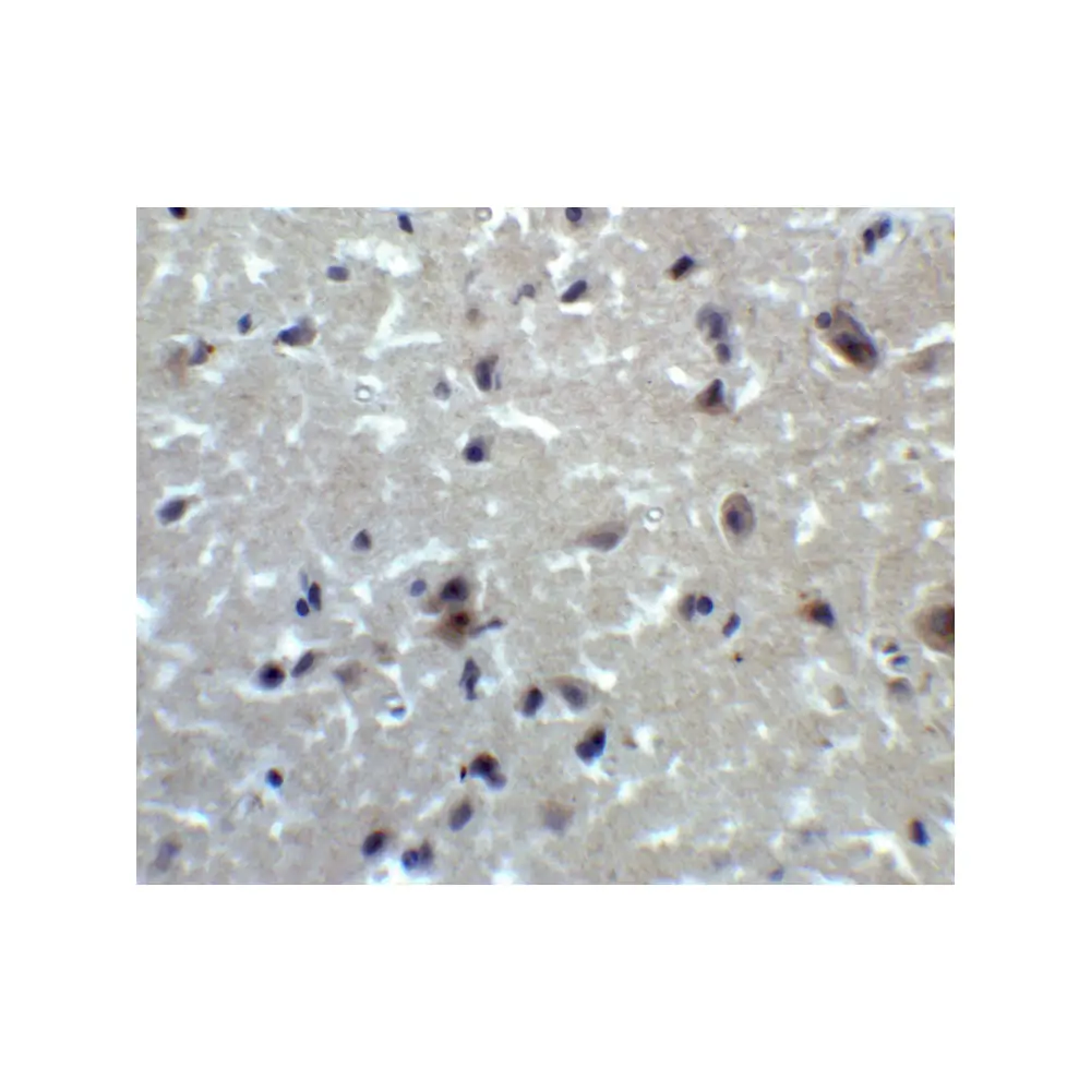 ProSci 5555 PRDM16 Antibody, ProSci, 0.1 mg/Unit Secondary Image