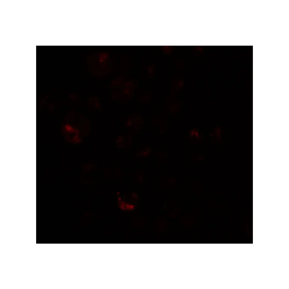 ProSci 6567_S PRICKLE4 Antibody, ProSci, 0.02 mg/Unit Tertiary Image