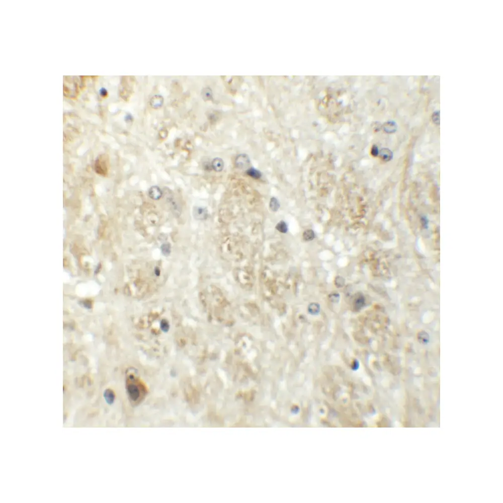 ProSci 6291 PRR5 Antibody, ProSci, 0.1 mg/Unit Secondary Image
