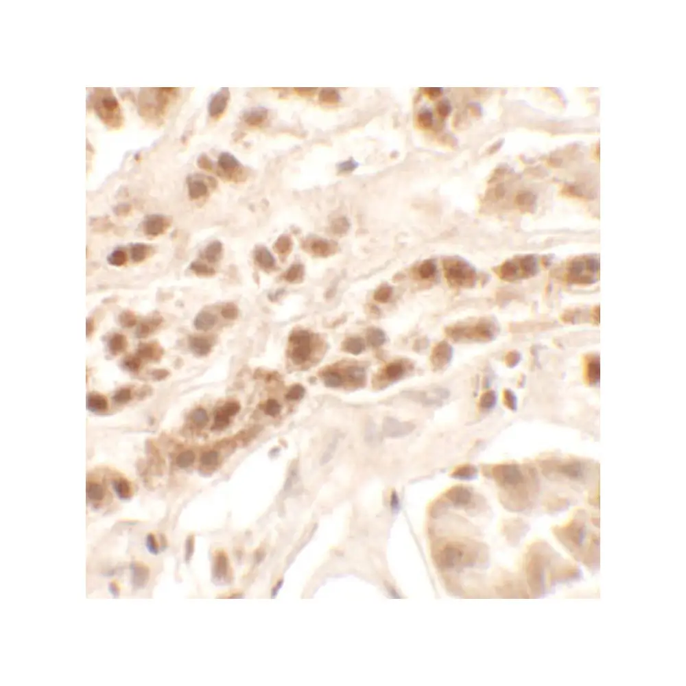 ProSci 6637_S PTCHD2 Antibody, ProSci, 0.02 mg/Unit Secondary Image