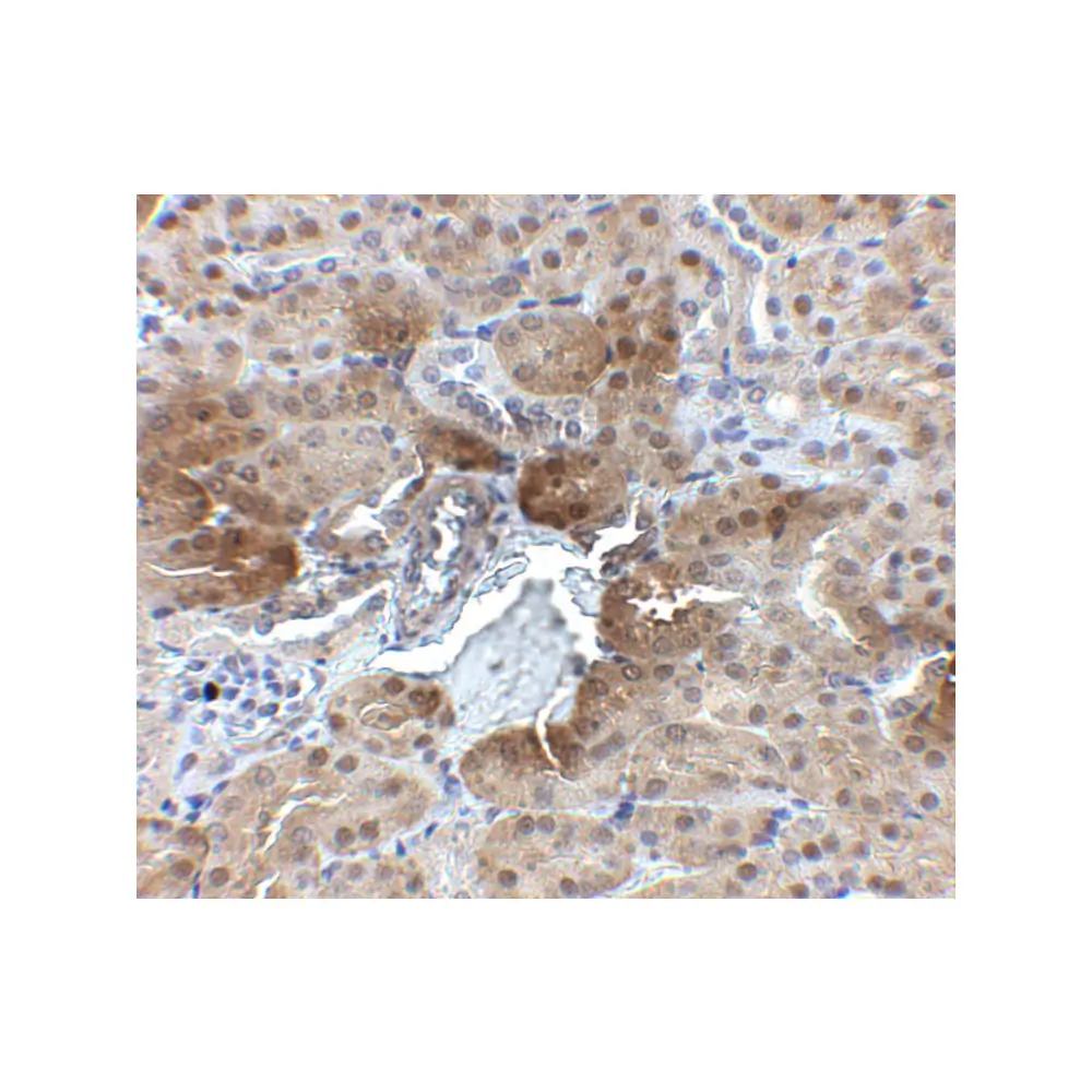 ProSci 5173_S PTER Antibody, ProSci, 0.02 mg/Unit Secondary Image