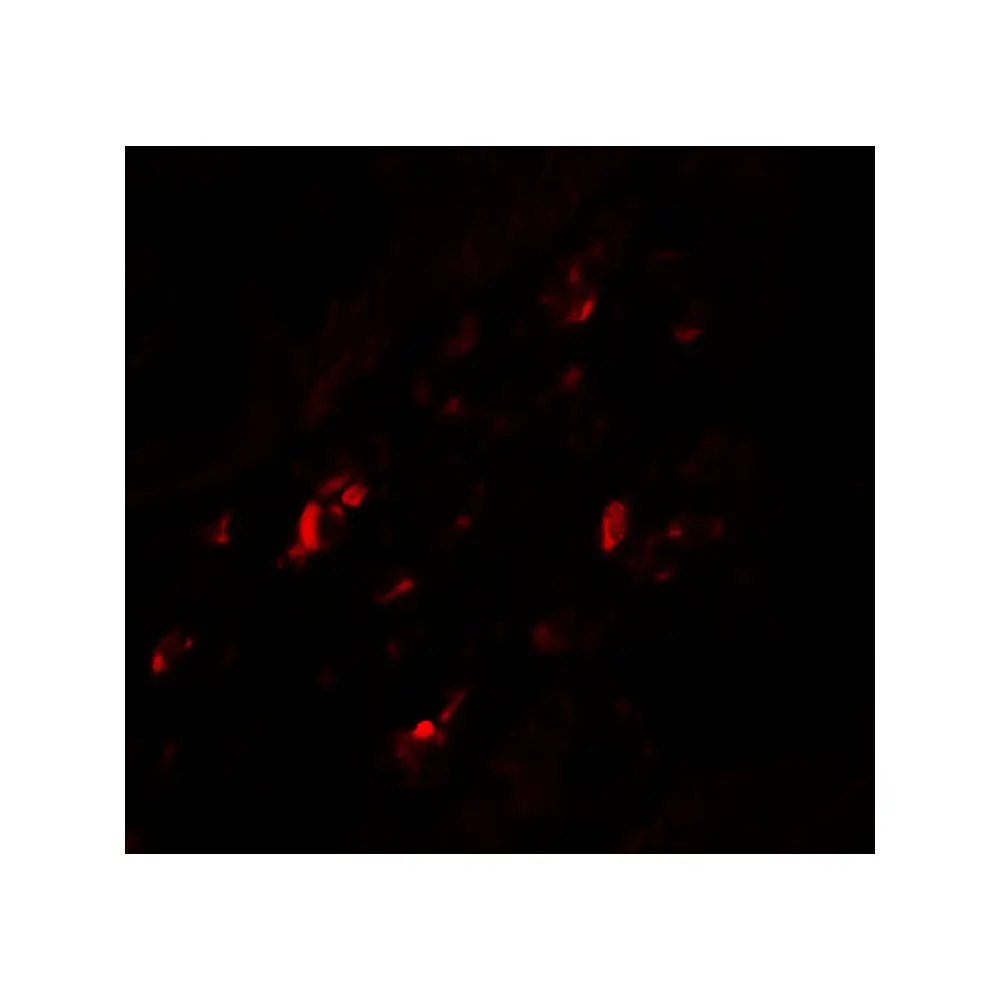 ProSci 7191 PTGDR2 Antibody, ProSci, 0.1 mg/Unit Secondary Image