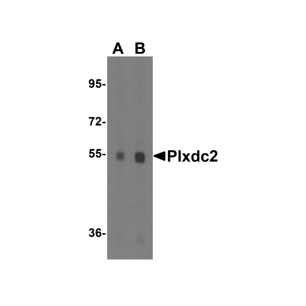 ProSci 4417 Plxdc2 Antibody, ProSci, 0.1 mg/Unit Quaternary Image