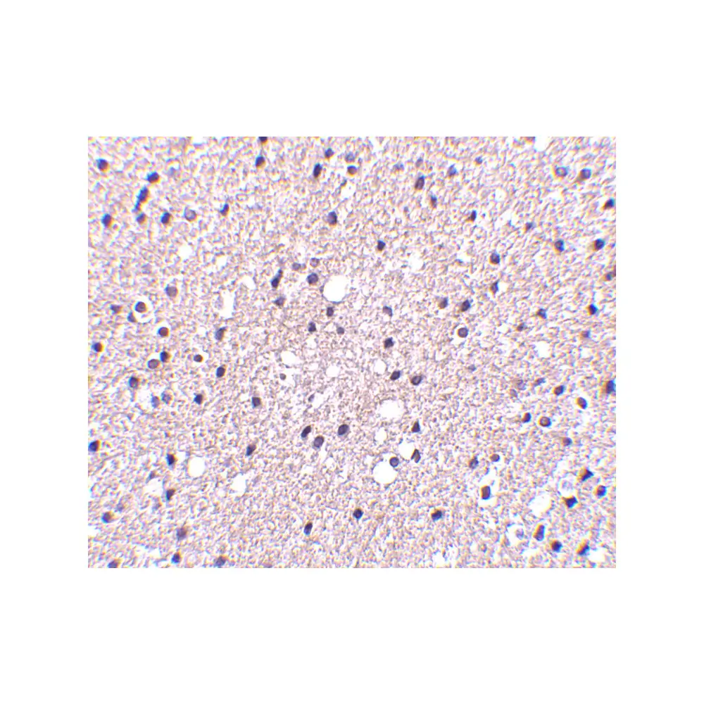ProSci 4203_S Presenilin1 Antibody, ProSci, 0.02 mg/Unit Secondary Image