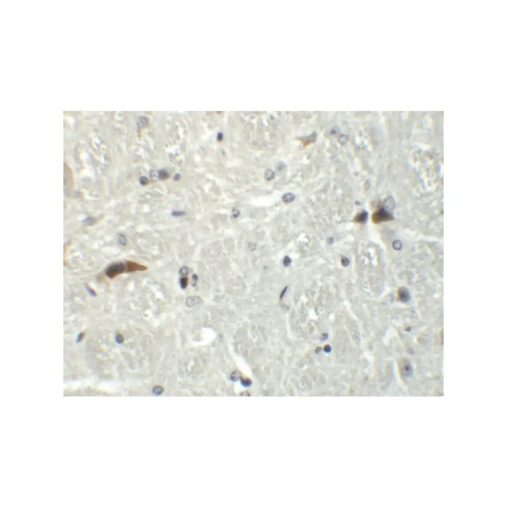ProSci 6225 RABEX5 Antibody, ProSci, 0.1 mg/Unit Secondary Image