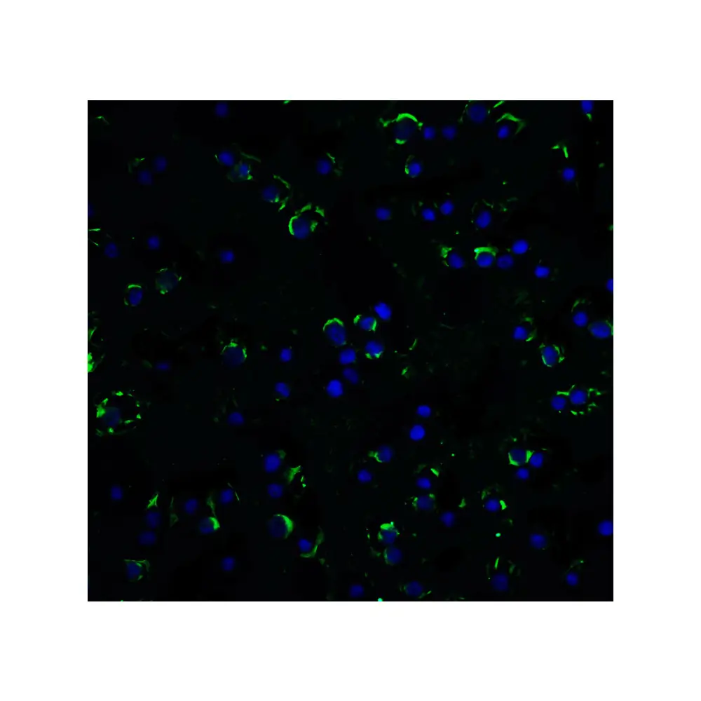 ProSci 1115 RAIDD Antibody, ProSci, 0.1 mg/Unit Quaternary Image