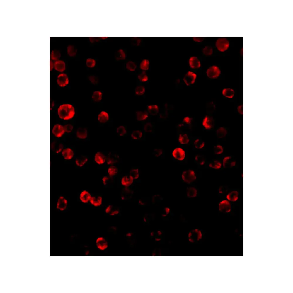 ProSci 1115 RAIDD Antibody, ProSci, 0.1 mg/Unit Tertiary Image