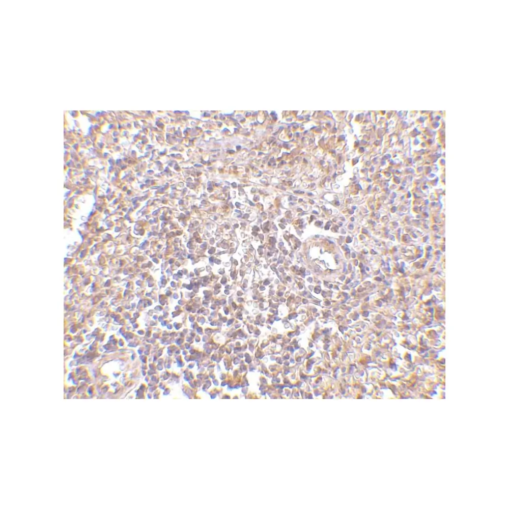 ProSci 4327 RAP80 Antibody, ProSci, 0.1 mg/Unit Secondary Image