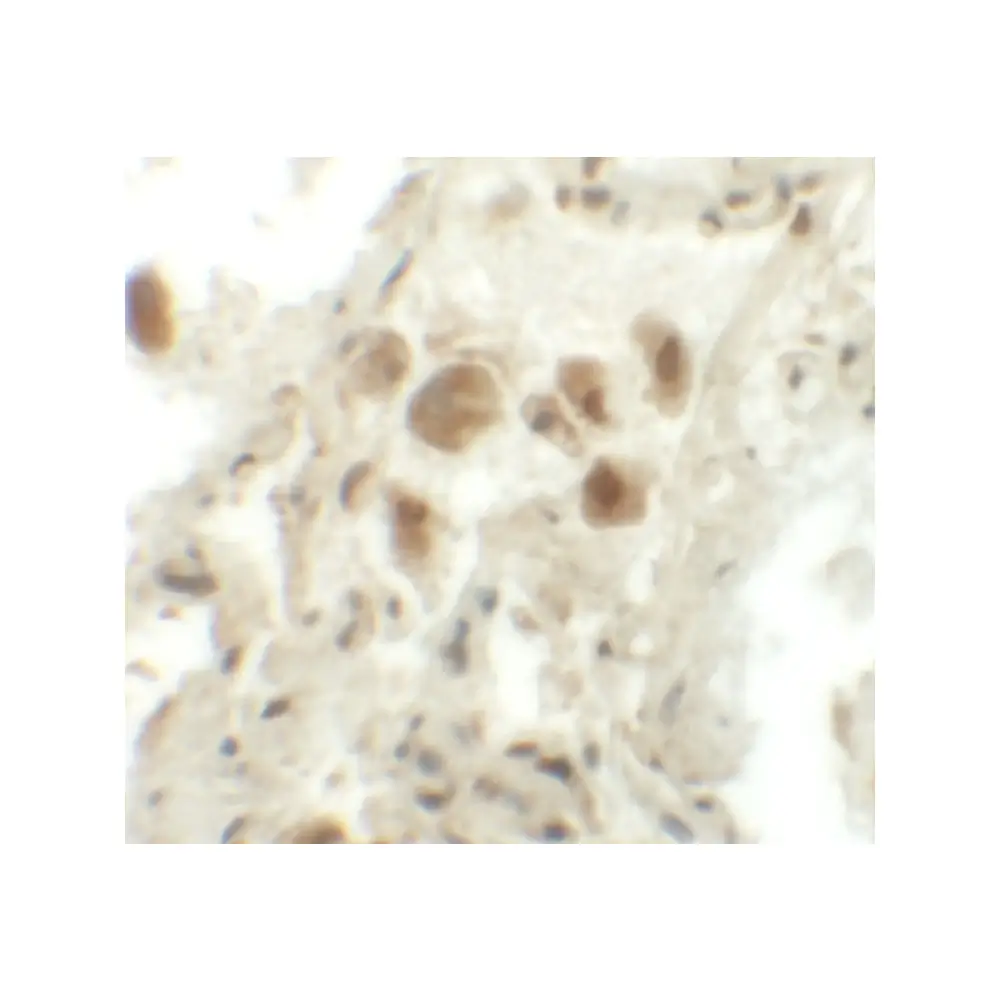 ProSci 6371 RASSF10 Antibody, ProSci, 0.1 mg/Unit Secondary Image
