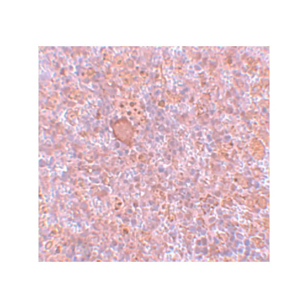 ProSci 5761_S RBBP8 Antibody, ProSci, 0.02 mg/Unit Secondary Image