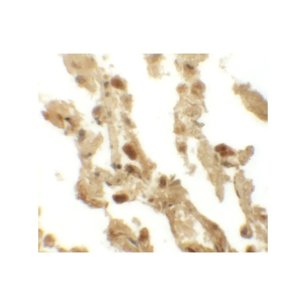 ProSci 6187 RBM35B Antibody, ProSci, 0.1 mg/Unit Secondary Image