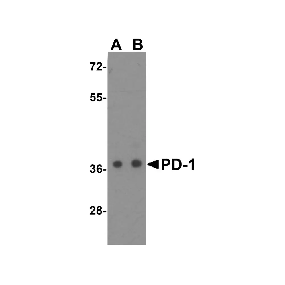 ProSci RF16001_S PD1 Antibody [4D6], ProSci, 0.02 mg/Unit Primary Image