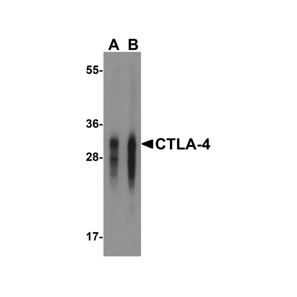 ProSci RF16011 CTLA4 Antibody [1E6], ProSci, 0.1 mg/Unit Primary Image