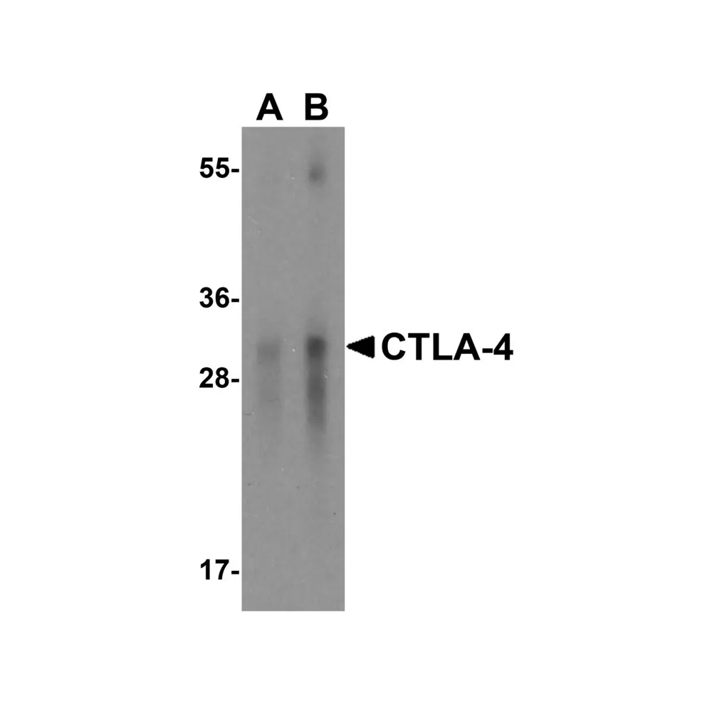 ProSci RF16012 CTLA4 Antibody [2G10], ProSci, 0.1 mg/Unit Primary Image