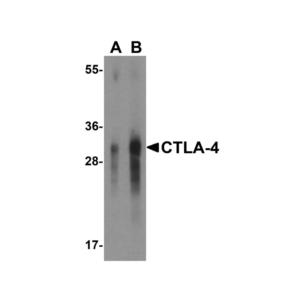 ProSci RF16013_S CTLA4 Antibody [8A1], ProSci, 0.02 mg/Unit Primary Image