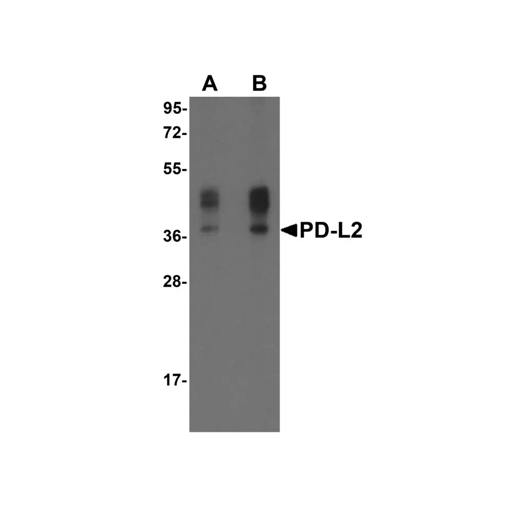 ProSci RF16021_S PDL2 Antibody [4E10], ProSci, 0.02 mg/Unit Primary Image