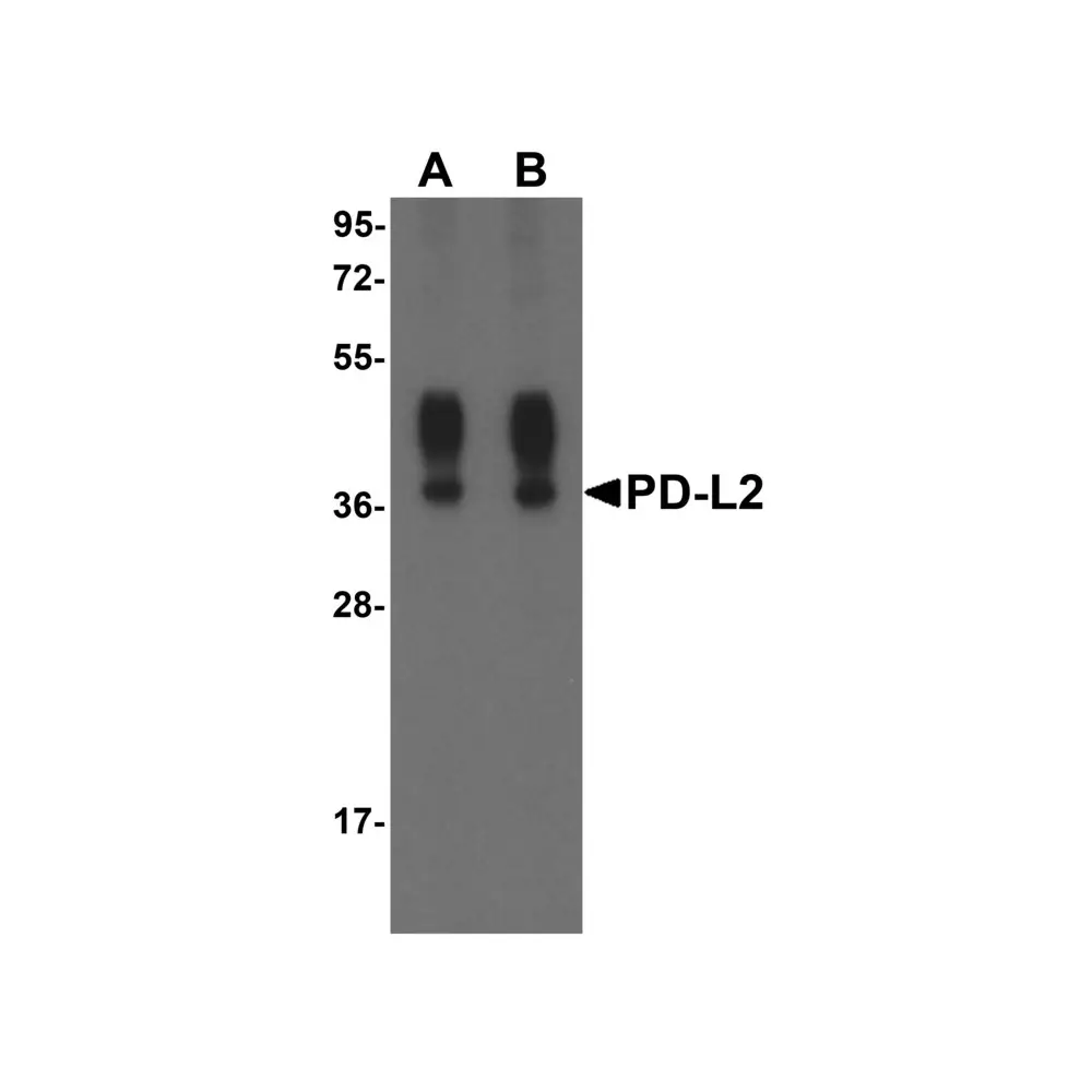 ProSci RF16022_S PDL2 Antibody [8C12], ProSci, 0.02 mg/Unit Primary Image