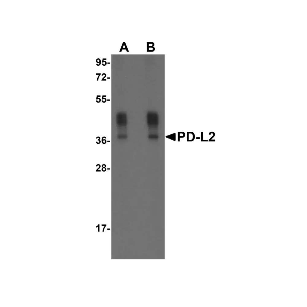 ProSci RF16023 PDL2 Antibody [7C7], ProSci, 0.1 mg/Unit Primary Image