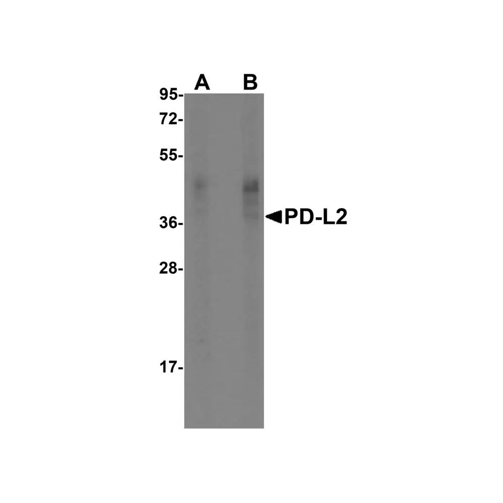 ProSci RF16024 PDL2 Antibody [7C1], ProSci, 0.1 mg/Unit Primary Image