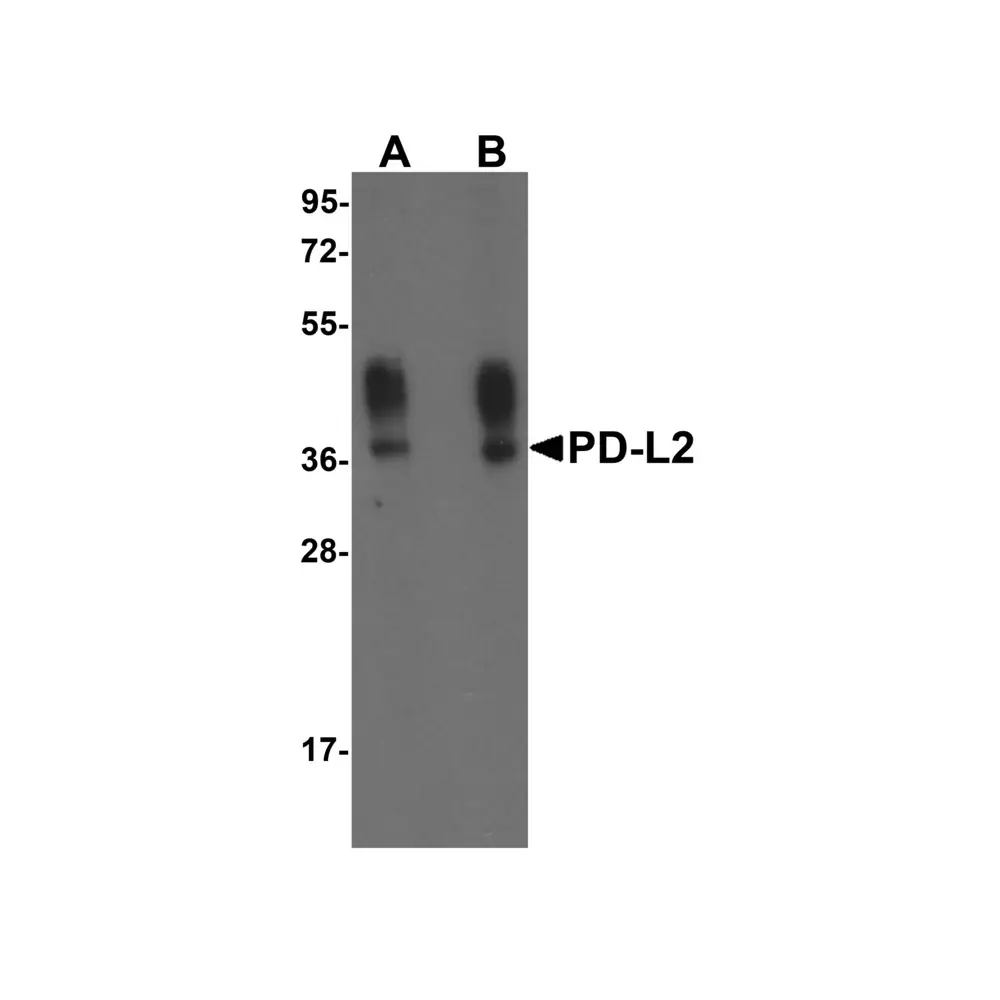 ProSci RF16025 PDL2 Antibody [10H6], ProSci, 0.1 mg/Unit Primary Image