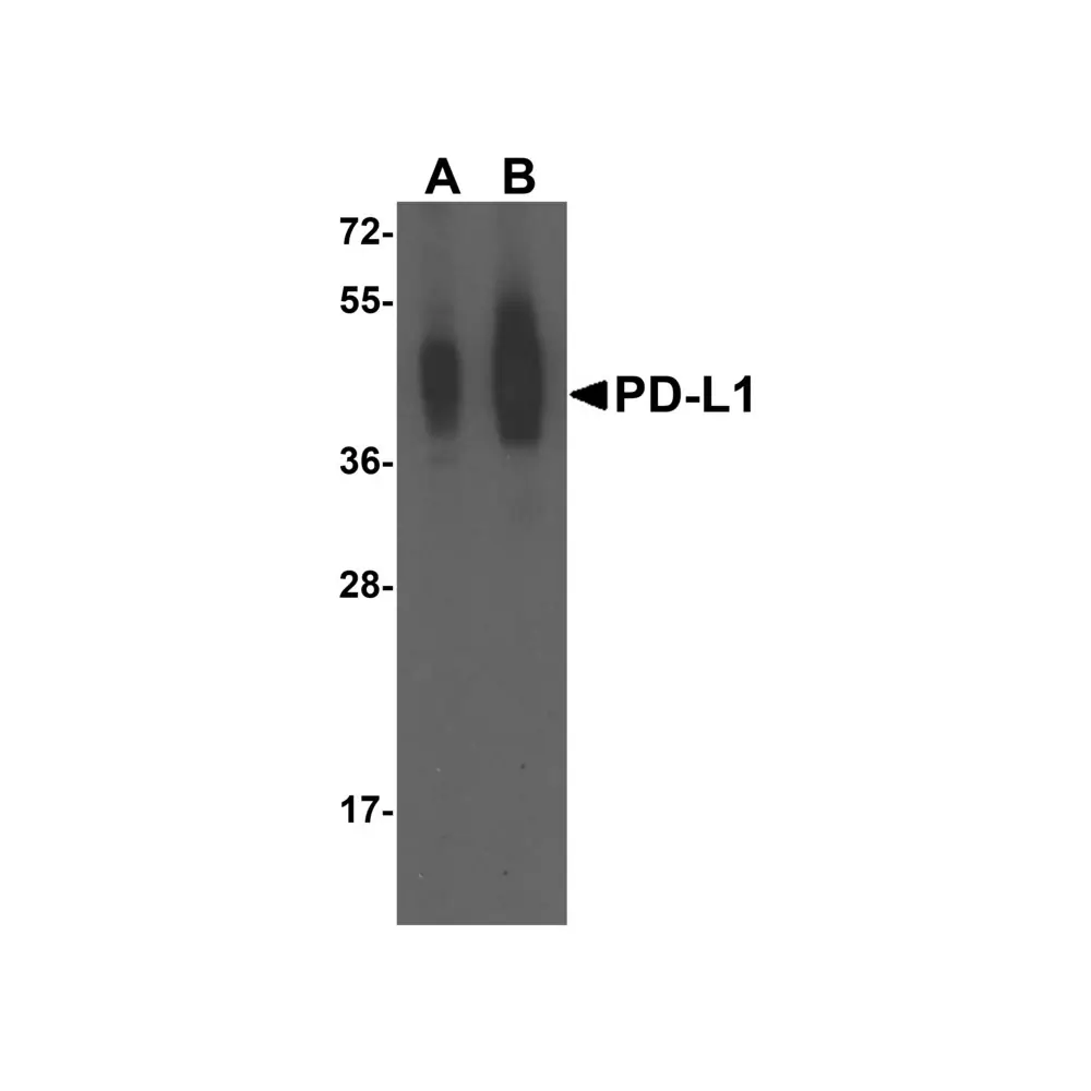 ProSci RF16031 PDL1 Antibody [4F2], ProSci, 0.1 mg/Unit Primary Image